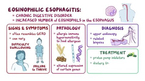 Eosinophilic Esophagitis Unraveling The Causes Symptoms And Advanced