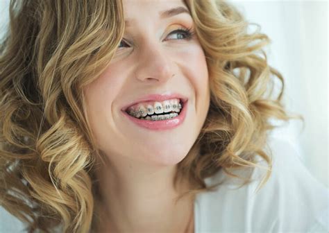 A Guide To Adult Braces We Cater To All Your Needs