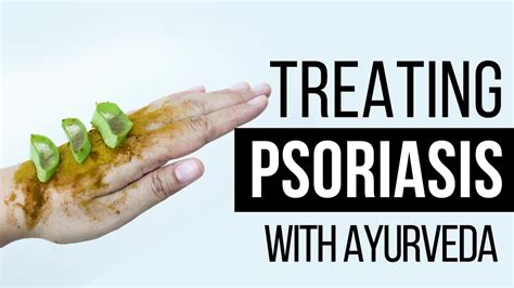 Free from any side effect, bactimo psor has shown best clinical results in chronic psoriasis patients who have been suffering from this diseases for more than 10 years also. Very effective Ayurveda treatment for Psoriasis - YouTube