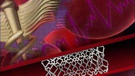 Bypass Better Than Stents New Study Says Cbs News