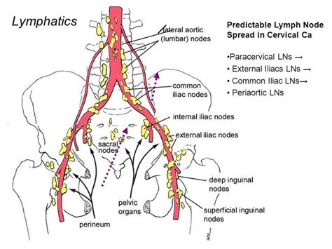 Image Result For Periaortic Node Map Crohns Chart