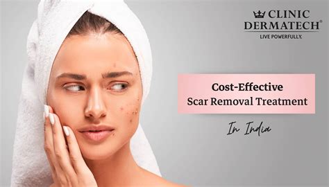 Cost Effective Acne Scar Removal Treatment In India