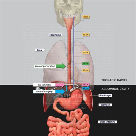 Human Body Diagram Esophagus Human Anatomy My Xxx Hot Girl