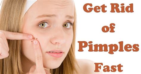 How To Get Rid Of Pimples Acne Overnight Fast Health And Care