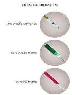 Three Types Of Biopsies Fine Needle Aspiration Core Needle Biospy And