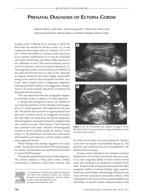 Pdf Prenatal Diagnosis Of Ectopia Cordis