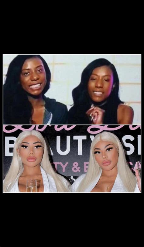 Clermont Twins Before After 🤯 Rbadgirlsclub