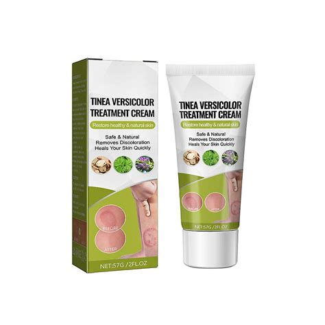 Tinea Versicolor Treatment Cream Body Antifungal Gel For Tinea