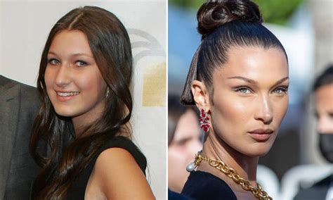 bella hadid fans question why she was allowed surgery at 14 capital