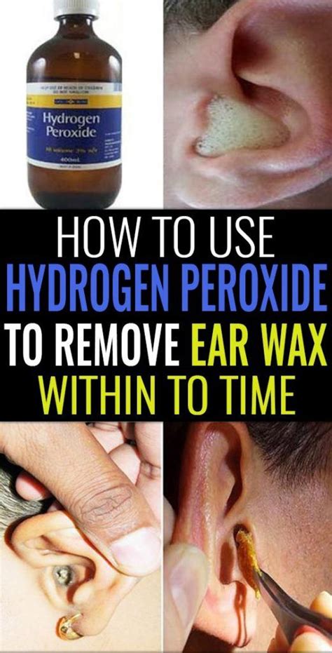 How To Use Hydrogen Peroxide To Remove Ear Wax Ear Cleaning Wax