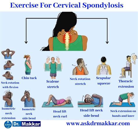 Cervical Spondylosis Neck Pain Neck Pain Leads To Giddiness Vertigo Cervical