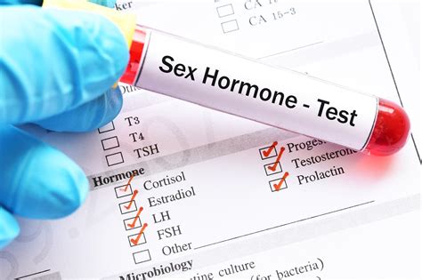 Pah Risk Mortality Increased By Disturbances In Male Sex Hormones The Cardiology Advisor
