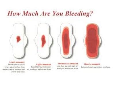Spotting, or light bleeding in early. Course Details: What should I do if I start bleeding during early pregnancy?