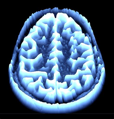 Brain Scan Photograph By Alfred Pasiekascience Photo Library Fine