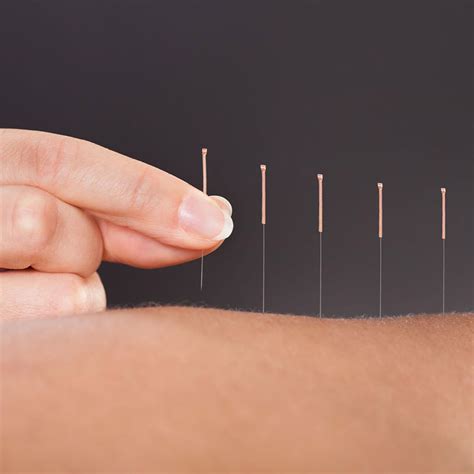 Medical Acupuncture Utilizing The Knowledge Of Anatomy And Physiology