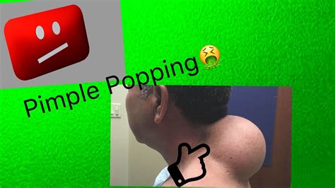 Man Squirts Pimple Juice Everywhere Gross Youtube