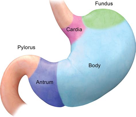 Beyond The Gist Mesenchymal Tumors Of The Stomach Radiographics