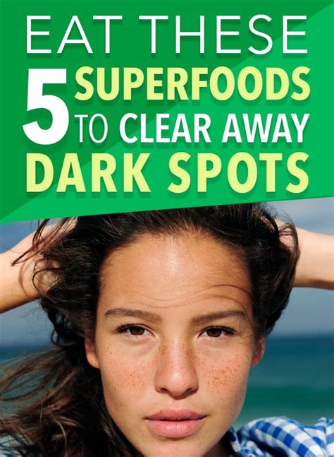 Clear Away Dark Spots With These Superfoods