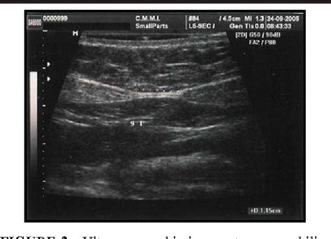 Table 2 From Ultrasonography For Measuring Rectus Abdominis Muscles
