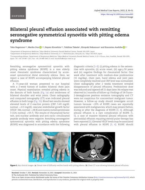 Pdf Bilateral Pleural Effusion Associated With Remitting Seronegative