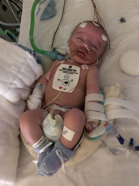 14 Week Old Baby Wakes Up After 5 Day Coma And Smiles Beautifully Right