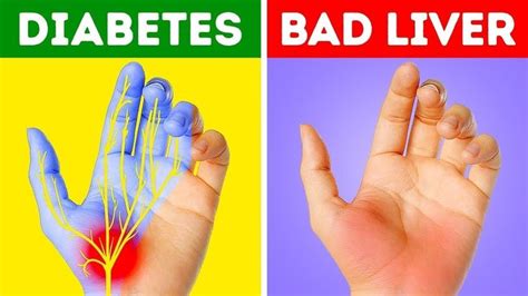 Health Tips 7 Things Your Hands Can Tell About Your Health Health