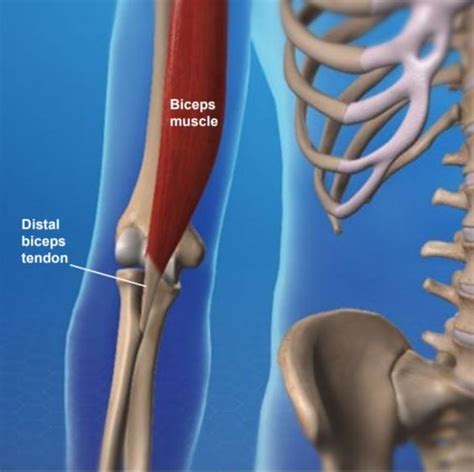 Distal Biceps Tendon