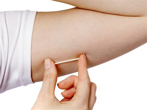 New Implant Device Provides Continuous Birth Control For Up To Three