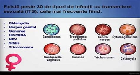 Download Free Medical Sexually Transmitted Infections Powerpoint