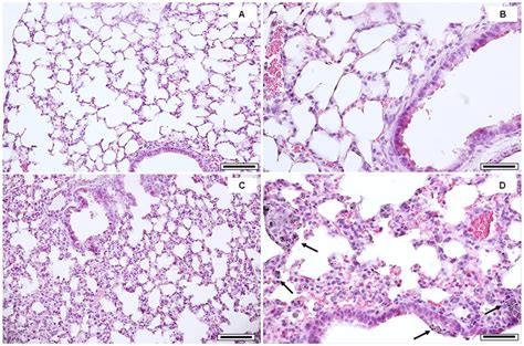 Histological Analysis Of Mouse Lungs Representative H E Stained Images