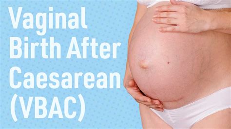 Vaginal Birth After Caesarean VBAC Ausmed