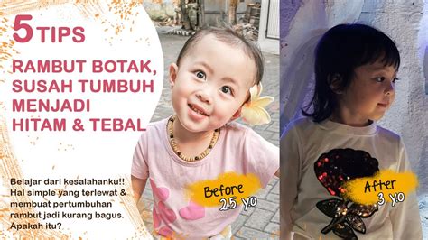 Namun tidak semua bayi terlahir dengan kondisi rambut yang seperti itu. TIPS RAMBUT BAYI LEBAT, HITAM, SECARA ALAMI AMPUH ! - YouTube