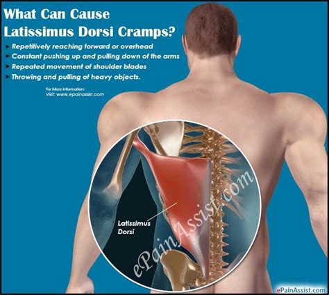 Latissimus Dorsi Pain Causes And How To Treat Them The Healthy My Xxx