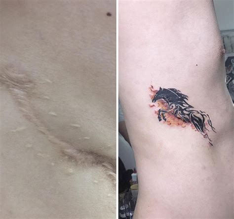 This Vietnamese Tattoo Artist Helps People Regain Confidence With Her
