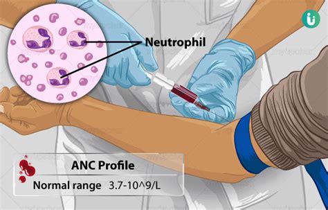 Absolute Neutrophil Count Anc Procedure Purpose Results Normal
