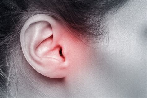 Ból ucha przyczyny objawy leczenie LekarzeBezKolejki