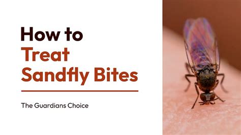 How To Treat Sandfly Bites Effectively Discover The Proven Method