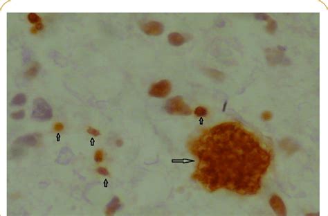 Toxoplasma Immunostaining Showing Many Bradyzoites In The Cyst Large