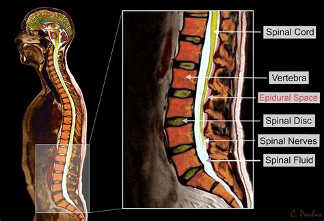 Lumbar Spine Mri Mri Scan Images Lumbar Spine Spine Anatomy Mri