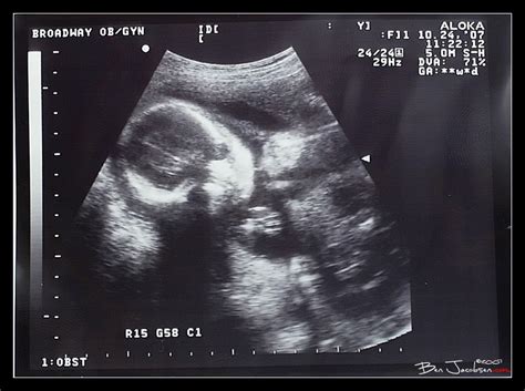 16 Week Baby Update