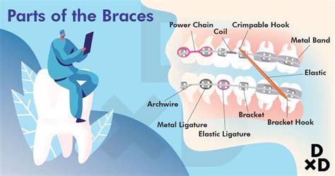 A Complete Dummies Guide To Braces In Singapore 2019
