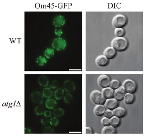 Monitoring Mitophagy In Yeast The Om45 GFP Processing Assay