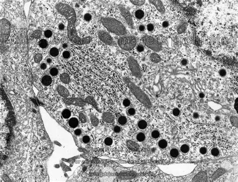 Enteroendocrine Cells Drjastrows Em Atlas