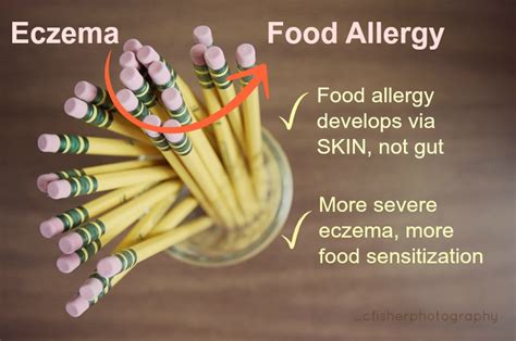 Eczema Research Focus Month Food Allergy Eczema Blues