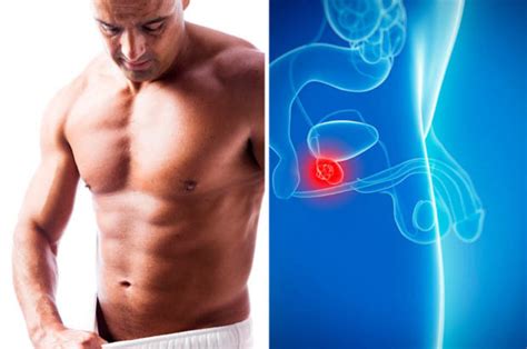 We list the stages below: Enlarged prostate symptoms: New treatment safer than ...