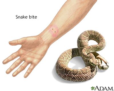 How Can You Tell If A Snake Bite Is Poisonous Snake Poin