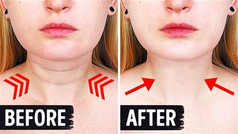 17 Home Tricks To Erase Neck Wrinkles Today Youtube