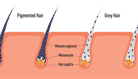Why Does Hair Turn Gray What Causes Premature Graying Of Hair My Xxx