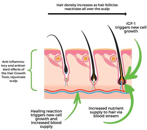 topical igf 1 for hair loss how to stop hair loss