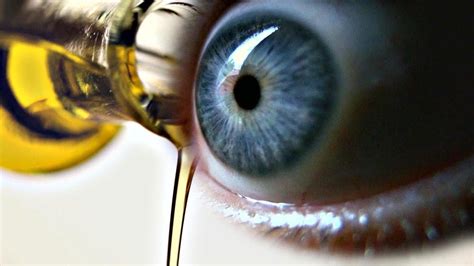 Use castor oil for eyelashes to get those bold beautiful lashes1 you always wanted. Does Castor Oil Help with Cataracts? - YouTube